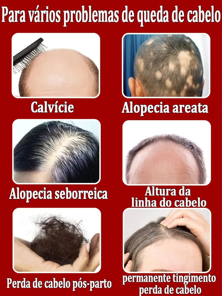HayrBoost Max-Crescimento capilar Avançado