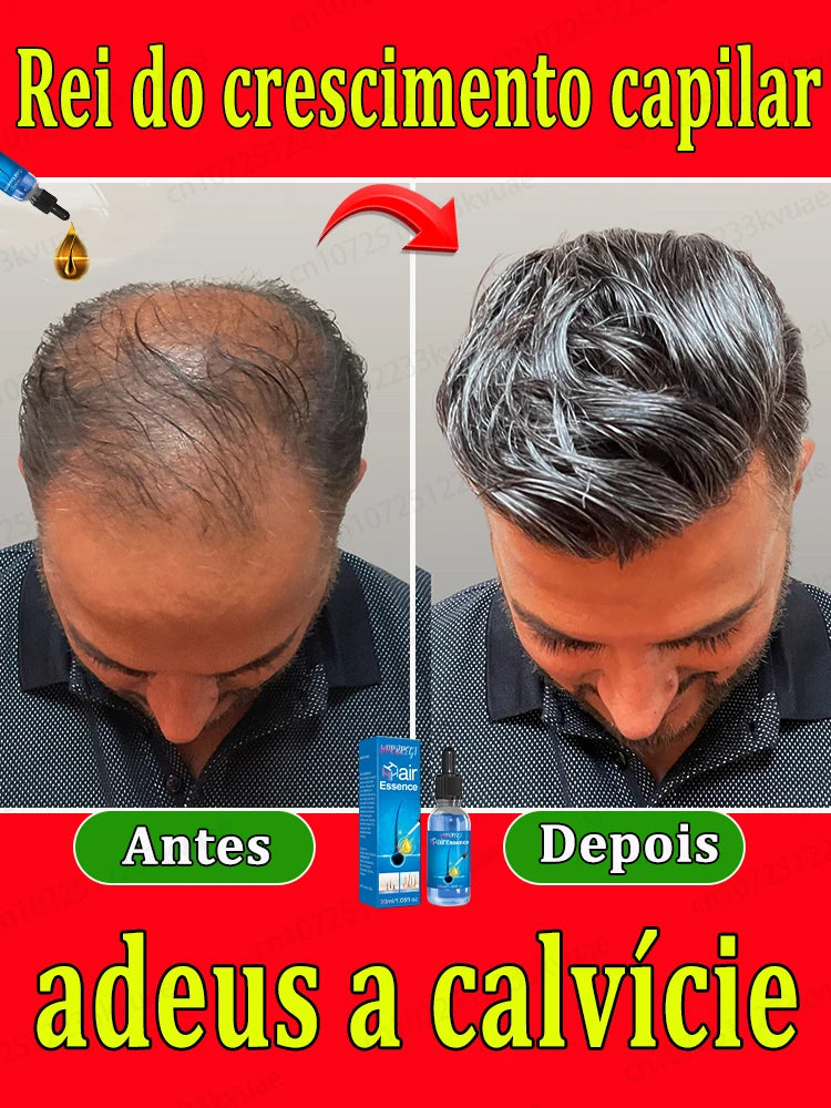 HayrBoost Max-Crescimento capilar Avançado