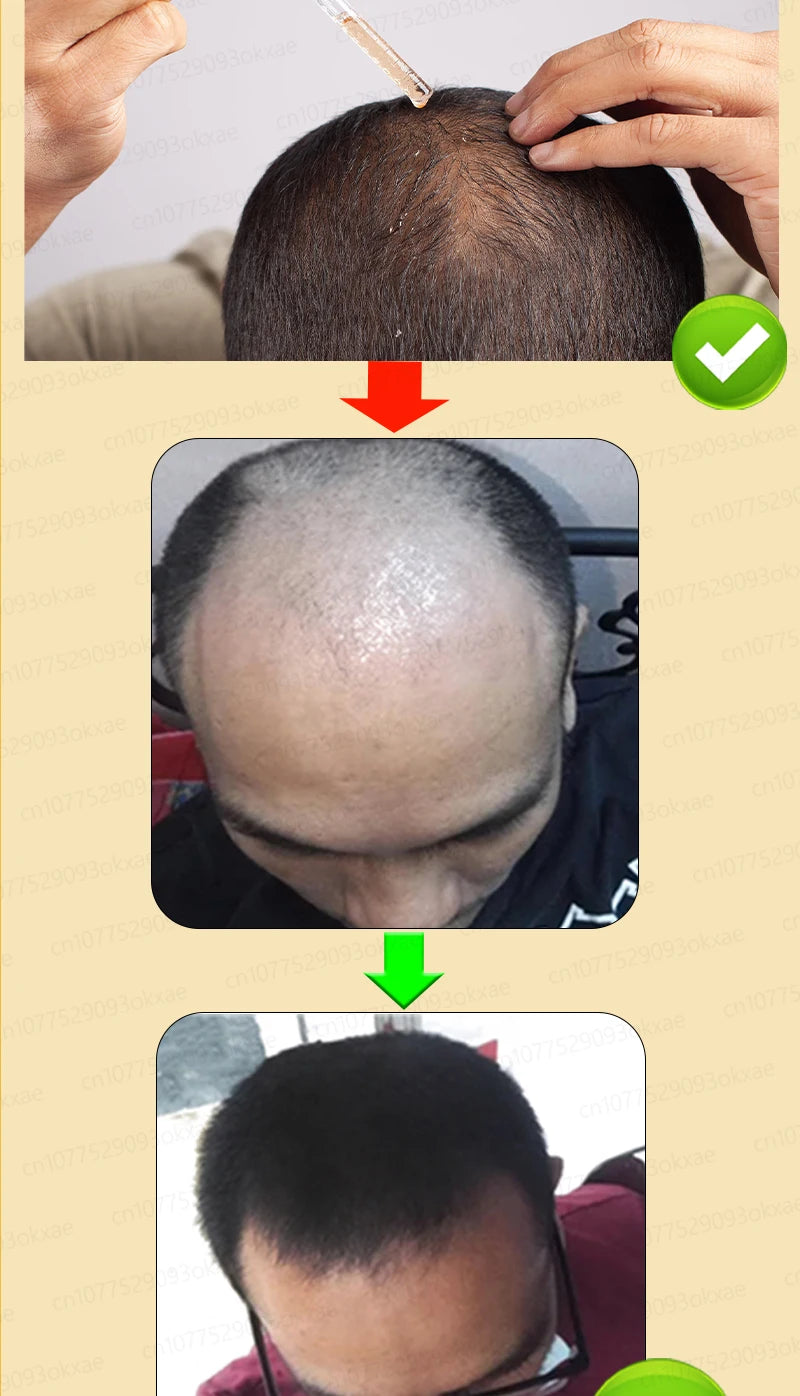 HayrBoost Max-Crescimento capilar Avançado
