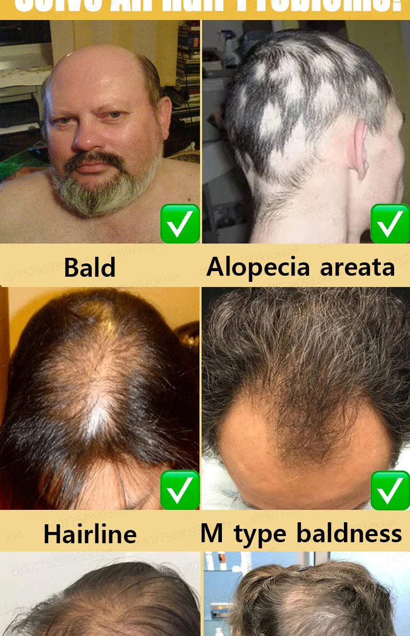 HayrBoost Max-Crescimento capilar Avançado