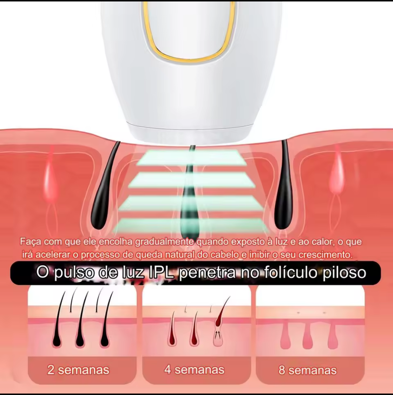 Depilador a Laser SkinGlow Pro