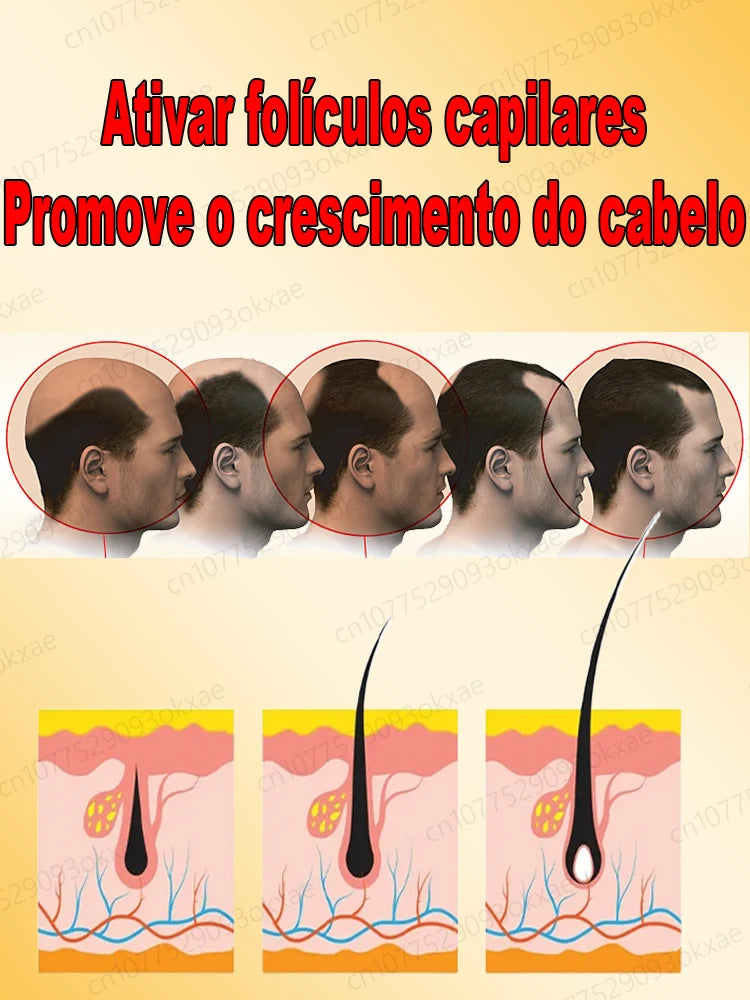 HayrBoost Max-Crescimento capilar Avançado